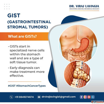 Personalised Stomach Cancer Treatment in Ahmedabad by Dr. Viraj Lavingia