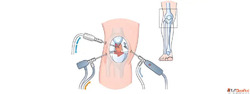 Affordable Arthroscopy Surgery in Ahmedabad - Experienced Sp...