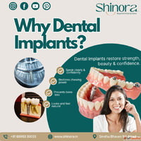 Book Dental Implant at Shinora Clinic - Ahmedabad