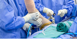 Shoulder Specialist in Gorakhpur
