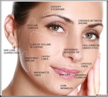 Affordable Dermal Fillers in Kingston Ontario