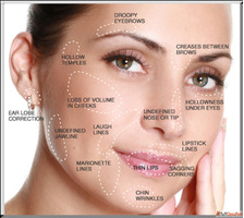 Affordable Dermal Fillers in Kingston Ontario