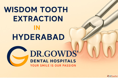 Expert Care at Dr. Gowds Dental for Wisdom Tooth Extraction