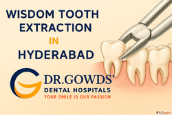 Expert Care at Dr. Gowds Dental for Wisdom Tooth Extraction