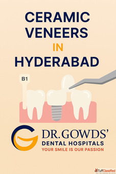 Ceramic Veneers in Hyderabad Dr. Gowd Dental Hospitals