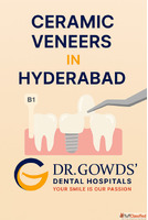 Ceramic Veneers in Hyderabad Dr. Gowd Dental Hospitals