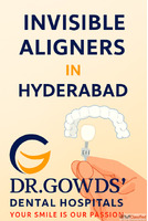 Invisible Aligners in Hyderabad Dr. Gowd Dental Hospitals