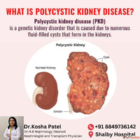 Specialized Treatment from the Best Nephrologist in Ahmedaba...
