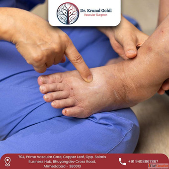 Dr. Krunal Gohil - Trusted for Best Diabetic Foot Treatment in India