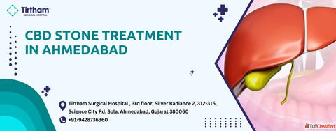 CBD Stone Removal Care in Ahmedabad