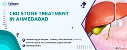 CBD Stone Removal Care in Ahmedabad
