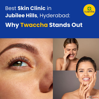 Best Skin Clinic in Jubilee Hills Hyderabad