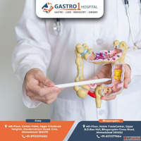 Leading Hospital for Colon Cancer Treatment in Ahmedabad - G...