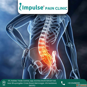 Sciatica Pain Treatment in Ahmedabad by Dr. Pratik Shah - Consult Today