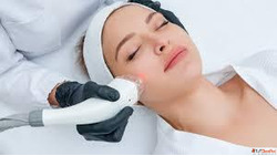 Laser Hair Removal in Ahmedabad Gujarat - Smooth Skin by Dr....