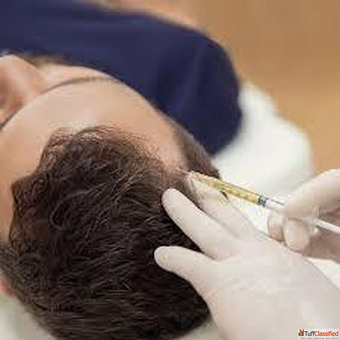 PRP Hair Treatment in Ahmedabad Gujarat - Expert Care by Dr. Krupa