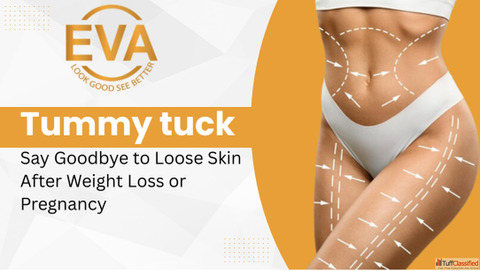 Flat Belly Goals Tummy Tuck Surgery Cost Experts in Delhi