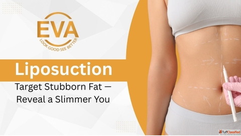 Advanced Liposuction Surgery in Delhi Cost Techniques Results