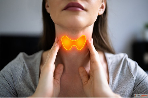Treat Your Thyroid Naturally with Homeopathic Medicine