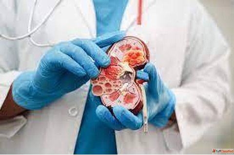 Pain-Free Kidney Stone Treatment Through Homeopathy