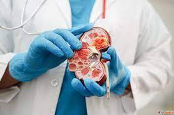 Pain-Free Kidney Stone Treatment Through Homeopathy
