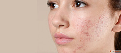 Skin Treatment by Top Homeopathy Doctor in Noida