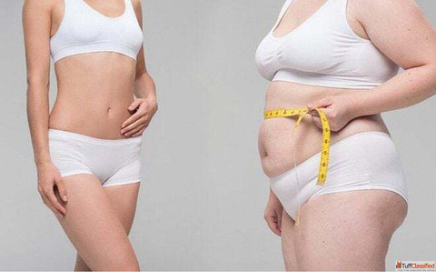 Best Weight Loss Treatment in Ahmedabad Gujarat - Dr. Krupa