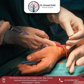 Choose Dr. Krunal Gohil - Best AV Fistula Surgeon in India for Expert Care