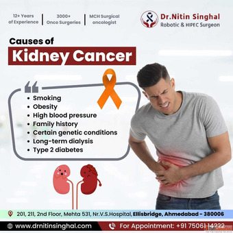 Kidney Cancer Surgeon in Ahmedabad Expert Care