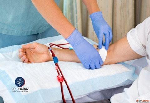 Expert AV Fistula Care in Mumbai India by Dr. Dharav Kheradia