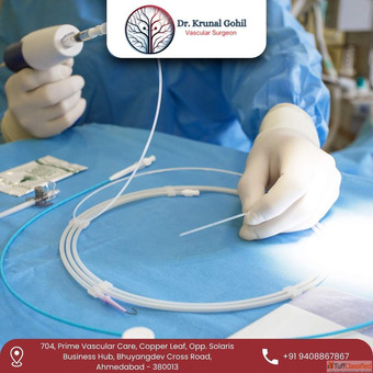 Experience Excellence with Best Endovascular Surgeon in India - Dr. Krunal Gohil