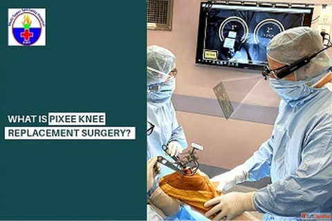 Looking for a Pixee Knee Replacement Surgery