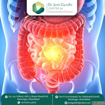 Best Gastro Surgeon in Ahmedabad India - Personalized Care by Dr. Jenit Gandhi