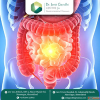 Best Gastro Surgeon in Ahmedabad India - Personalized Care b...