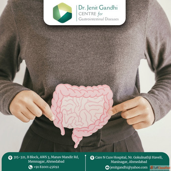 Leading Colon Cancer Specialist in Ahmedabad for Advanced Care