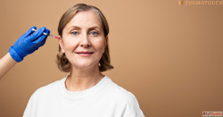 Anti Aging Treatment in Indore CosmoTouch Clinic