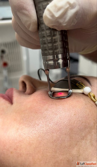 Proctology Laser Machine Manufacturers - Phoxton Best Offers Available