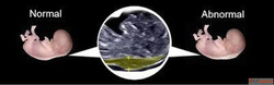 Best NT SCAN Fetal India