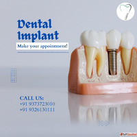 Restore Your Smile at the Best Implant Center in Goa