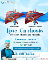 Liver Cirrhosis Treatment in Indore Dr Vineet Gautam