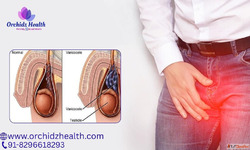 Best Varicocele Treatment in Bangalore for Men at Orchidz He...