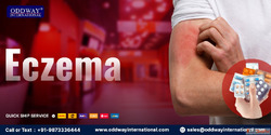 Effective Eczema Care Solutions from Oddway International Ph...