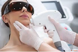 Advanced Laser Treatment in Ahmedabad Gujarat - Safe Effecti...