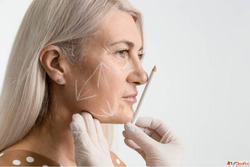 Facelift Treatment in Islamabad