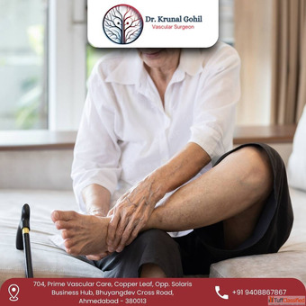 Dr. Krunal Gohil - Trusted Specialist for Peripheral Arterial Disease in India