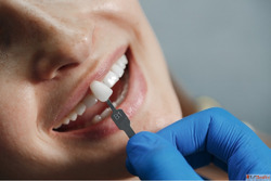 Dental Implants Treatment in Kukatpally Banjara Hills
