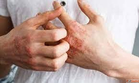 Best Homeopathy Doctor for Skin Problems in Gaur City