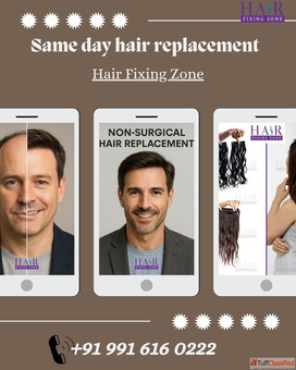 same day hair replacement- Hair Fixing Zone