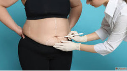 Advanced Bariatric Surgery in Ahmedabad by Dr. Digvijay Sing...