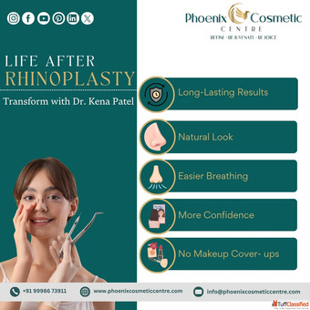 Rhinoplasty Solutions in Ahmedabad - Phoenix Cosmetic Centre